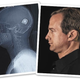 Image for article titled From the Archives: Wired's Bionic Quest for Boléro